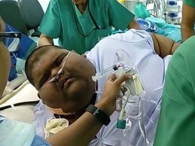 Самый толстый ребенок в мире смог похудеть
