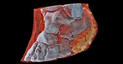 Ученые показали первые первые снимки тканей человека на цветном рентгене