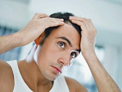 Названа неизвестная ранее причина выпадения волос у мужчин