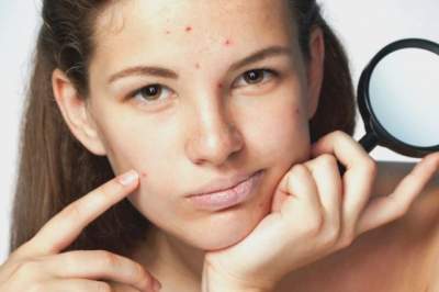 Медики рассказали о связи между гормонами и кожей лица
