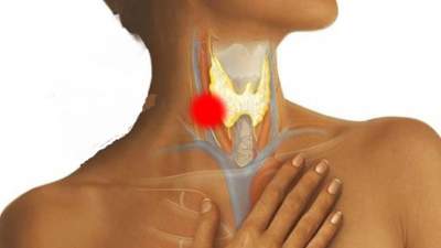 Названы первые возможные симптомы рака горла